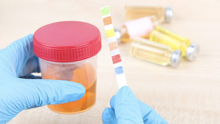 Cracking the Code: Secrets to Successfully Passing a Drug Test