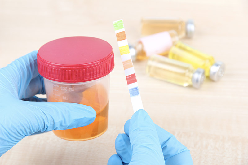 Cracking the Code: Secrets to Successfully Passing a Drug Test